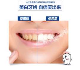 蓝光牙齿美白仪去黄牙黑牙速效洗牙器美牙仪神器去除氟斑牙