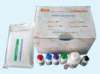 肝吸虫IgG抗体检测试剂盒